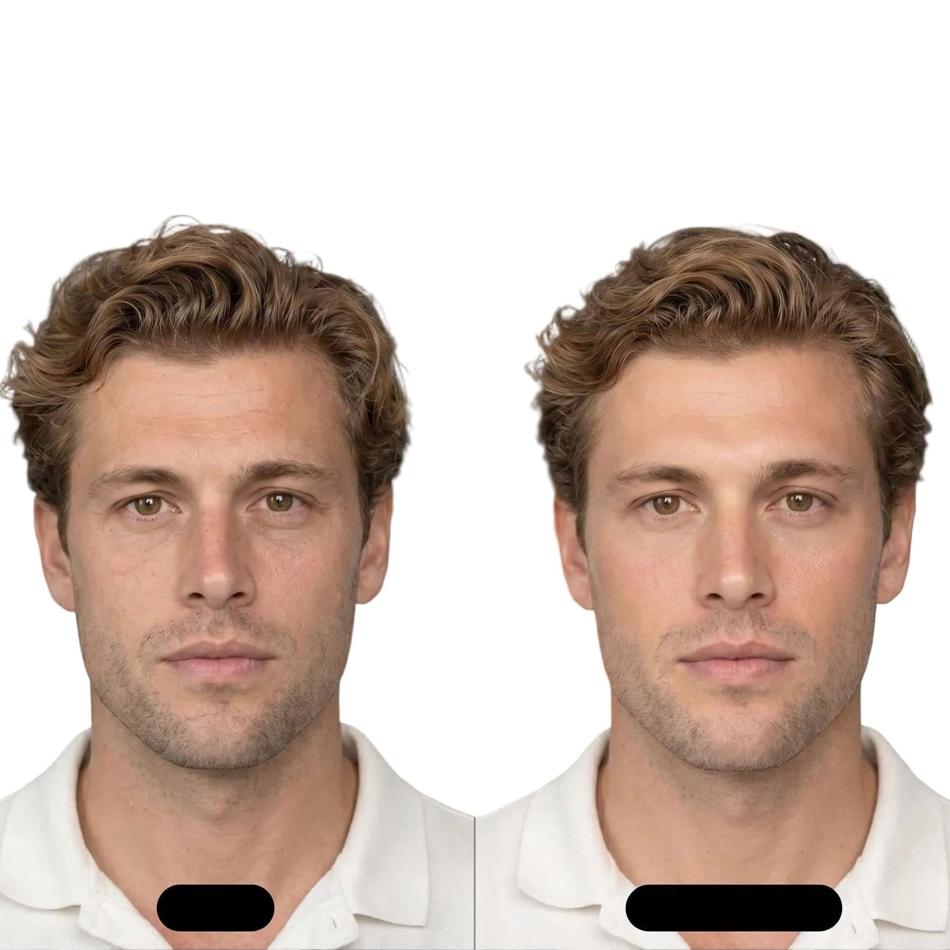 Bakuchiol Night Oil Serum - Before and After Appearance | OLIRS Men's Skincare