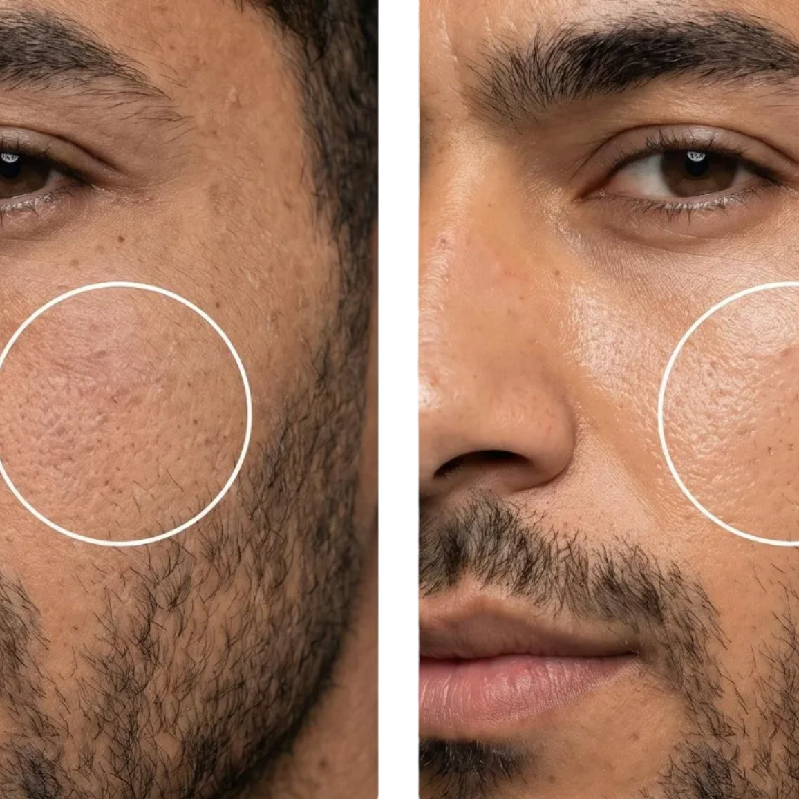 All-In-One Facial Oil - Before and After Appearance | OLIRS Men's Skincare